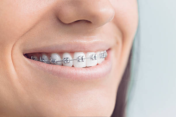 Full Mouth Reconstruction in Laplace, LA